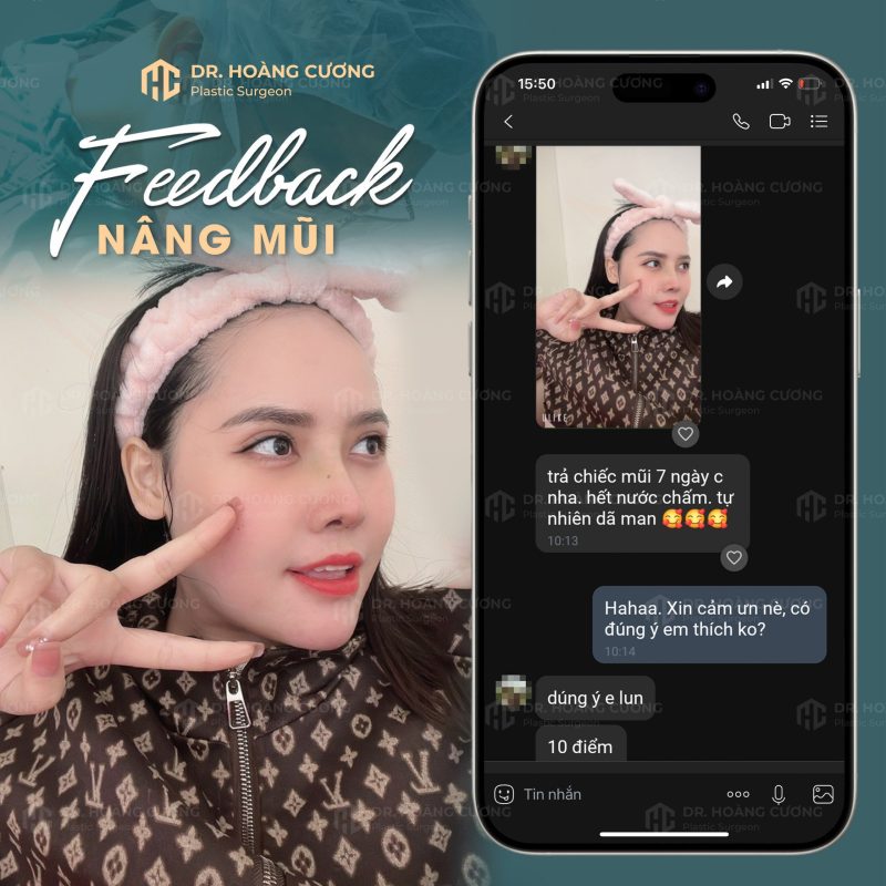 Feedback mũi trong 7 ngày do bác sĩ Hoàng Cương thực hiện